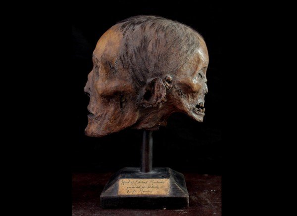 Edward Mordrake Skull